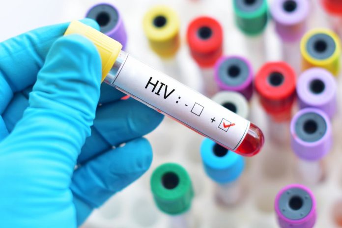 HIV එන්නත අසාර්ථකයි