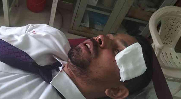 aya yanna giya makila