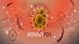 මංකි පොක්ස් ලංකාවට